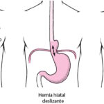 esofago y estómago